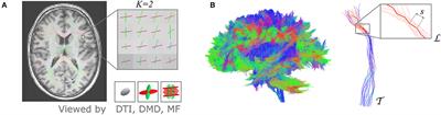 Unraveling multi-fixel microstructure with tractography and angular weighting